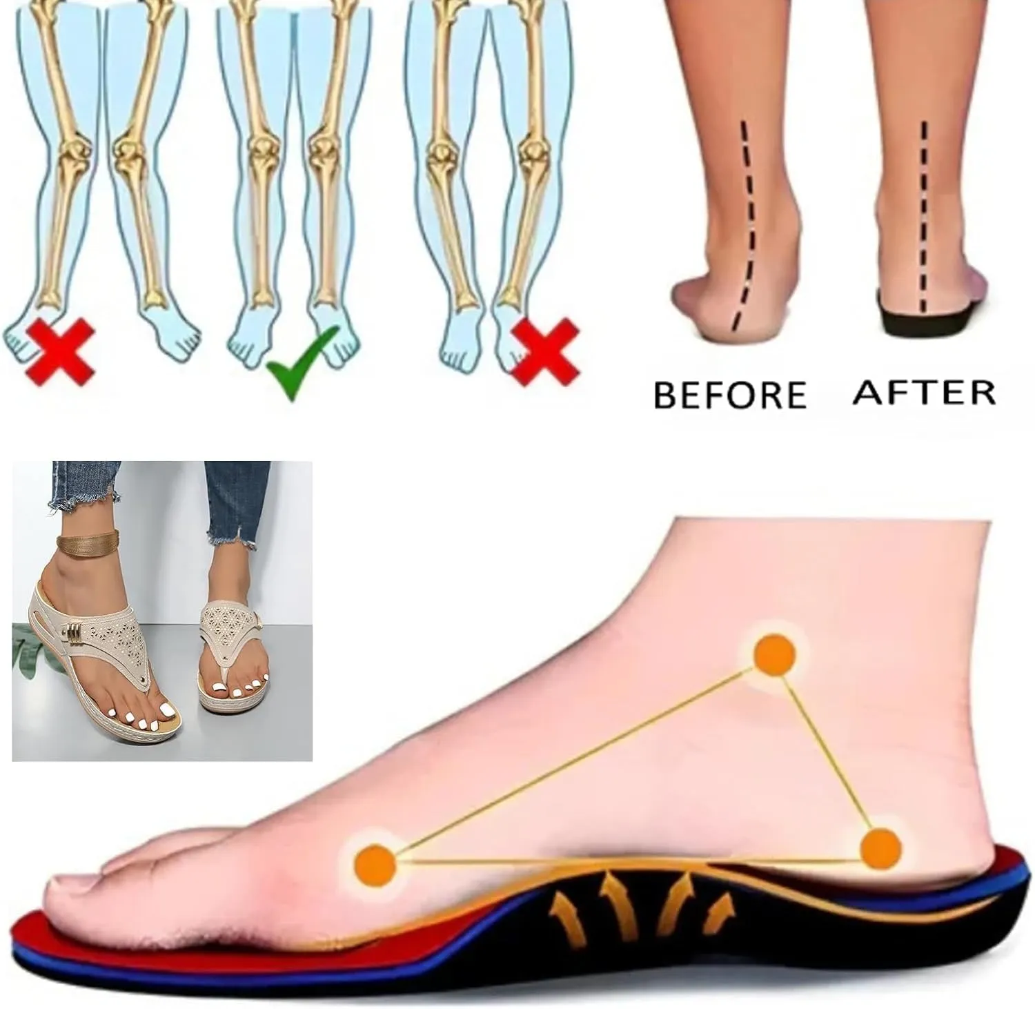 Womens Orthopedic Sandals Arch Support, Breathable Mesh Hollow Anti-Slip Sport Sandals, Orthopedic Flip-Flops Walking Sandals
